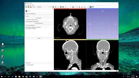 democratiz3d|How to Easily and Automatically Convert a CT Scan .